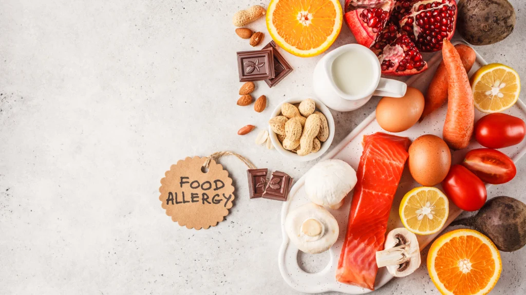 Food Allergies and Intolerances 8