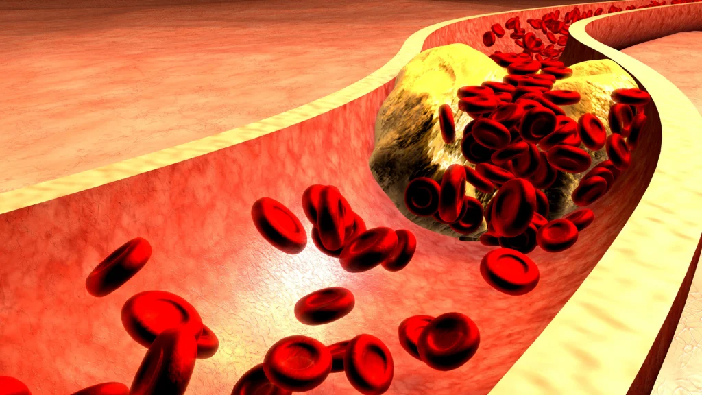 Cholesterol and Heart Health 9